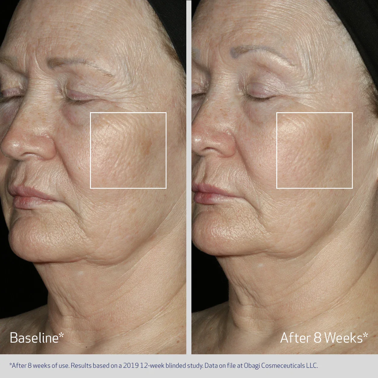 FACIAL SERUM - Image 5