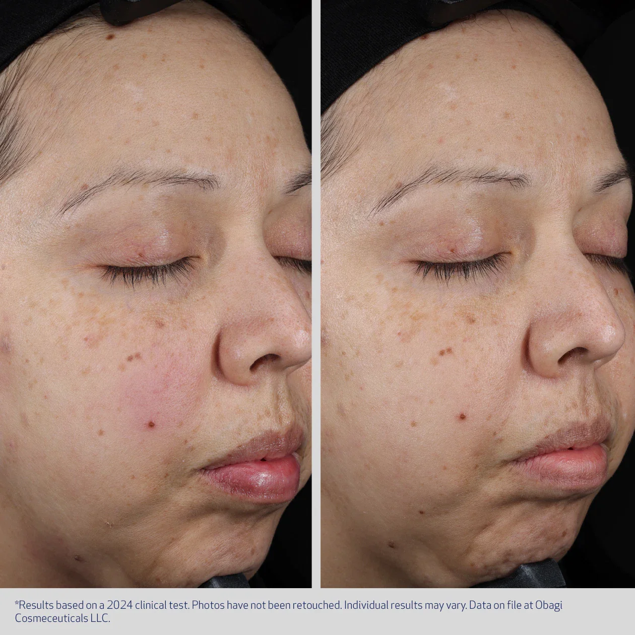 MOISTURE RESTORE - Image 5